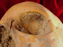 Attēlu rezultāti vaicājumam “Cribraria piriformis stalked”