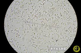 Attēlu rezultāti vaicājumam “Cinereomyces lindbladii”