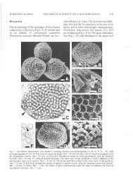 Attēlu rezultāti vaicājumam “Perichaena corticalis sessile”