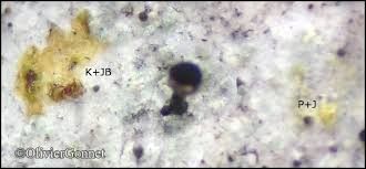 Attēlu rezultāti vaicājumam “Calicium salicinum”