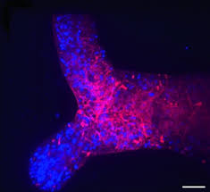 Attēlu rezultāti vaicājumam “Physarum virescens plasmodium”