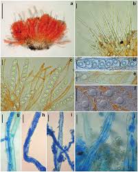 Attēlu rezultāti vaicājumam “Octosporella jungermanniarum”