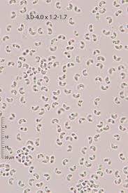Attēlu rezultāti vaicājumam “Sidera lenis”