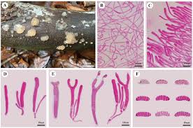 Attēlu rezultāti vaicājumam “Dacrymyces chrysospermus spores”