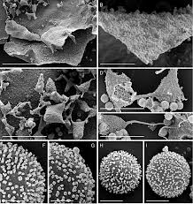 Attēlu rezultāti vaicājumam “Physarum pezizoideum spores”