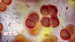 Attēlu rezultāti vaicājumam “Gloeocapsa rupestris”