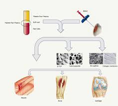 Image result for BMAC