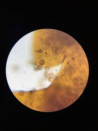 Attēlu rezultāti vaicājumam “Licea pygmaea spores”