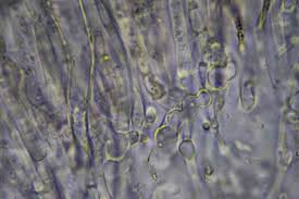 Attēlu rezultāti vaicājumam “Ombrophila violacea”