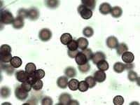 Attēlu rezultāti vaicājumam “Didymium bahiense”