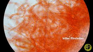 Attēlu rezultāti vaicājumam “Hyphodontia barba-jovis”