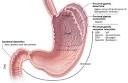 Gastroparesis: Introduction