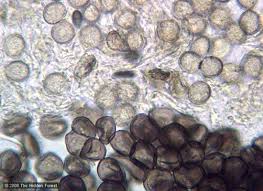 Attēlu rezultāti vaicājumam “Comatricha fragilis spores”