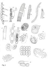 Attēlu rezultāti vaicājumam “Gloeocapsa rupestris”