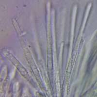 Attēlu rezultāti vaicājumam “Melanospora lagenaria”