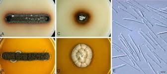 Attēlu rezultāti vaicājumam “Fuligo gyrosa macro”