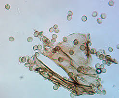 Attēlu rezultāti vaicājumam “Reticularia jurana”