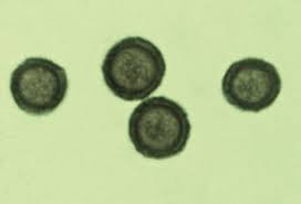 Attēlu rezultāti vaicājumam “Ceratiomyxa fruticulosa plasmodium”
