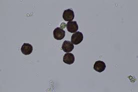 Attēlu rezultāti vaicājumam “Diderma subviridifuscum”