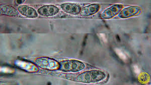 Attēlu rezultāti vaicājumam “Neonectria fuckeliana”