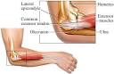 Tennis Elbow Anatomy: Lateral (Side) View: Healthwise Medical ...