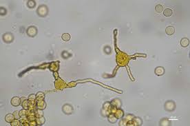 Attēlu rezultāti vaicājumam “Hemitrichia sordivesiculosa macro”