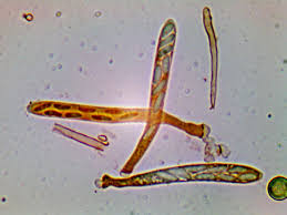 Attēlu rezultāti vaicājumam “Mollisia amenticola”