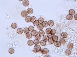 Attēlu rezultāti vaicājumam “Didymium squamulosum spores”