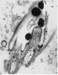 Attēlu rezultāti vaicājumam “Physarum flavicomum stalked”