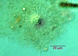 Attēlu rezultāti vaicājumam “Nostoc pruniforme cells”