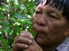 (<b>Tuberculose Genital Masculina</b>