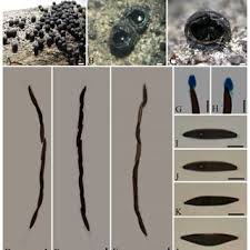 Attēlu rezultāti vaicājumam “Rosellinia desmazieri spores”