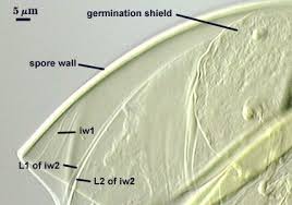 Attēlu rezultāti vaicājumam “Physarum virescens spores”