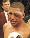 after a fight