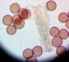 Attēlu rezultāti vaicājumam “Badhamiopsis scripta spores”