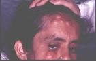 <b>GARDNER'S SYNDROME</b>. Rating: