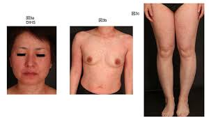 Image result for 向精神薬副作用