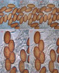 Attēlu rezultāti vaicājumam “Ascobolus furfuraceus”