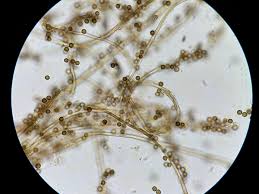 Attēlu rezultāti vaicājumam “Didymium serpula spores”