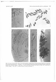 Attēlu rezultāti vaicājumam “Ascocoryne cylichnium”