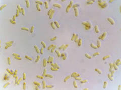 Attēlu rezultāti vaicājumam “Elmerina caryae”