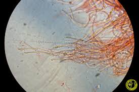 Attēlu rezultāti vaicājumam “Cinereomyces lindbladii”