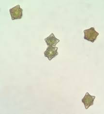 Attēlu rezultāti vaicājumam “Isopaches bicrenatus”