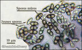 Attēlu rezultāti vaicājumam “Calicium viride”