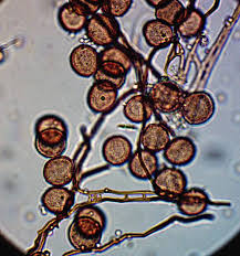 Attēlu rezultāti vaicājumam “Diderma spumarioides plasmodium”