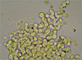 Attēlu rezultāti vaicājumam “Erythricium aurantiacum”
