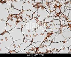 Attēlu rezultāti vaicājumam “Stemonitopsis hyperopta var. landewaldii spores”