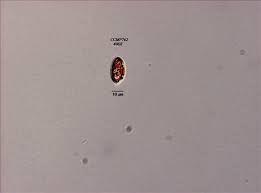 Attēlu rezultāti vaicājumam “Clastodermataceae”