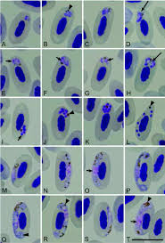 Attēlu rezultāti vaicājumam “Reticularia lobata plasmodium”