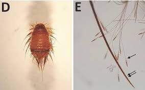 Attēlu rezultāti vaicājumam “Anthrenus sp.”